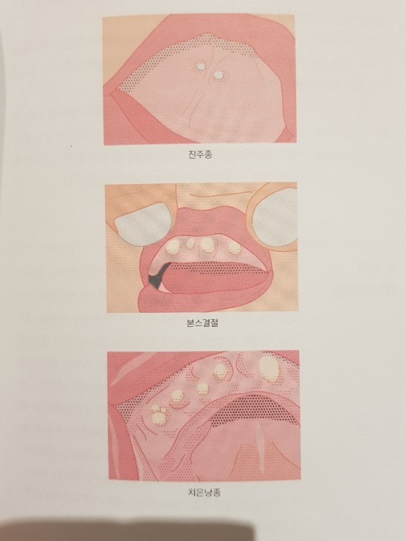 첨부된 사진