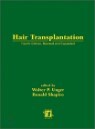 Hair Transplantation, 4/E