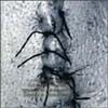 Scheer - Infliction