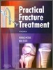 Practical Fracture Treatment, 5/E