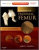 Fractures of the Proximal Femur : Improving Outcomes : Expert Consult