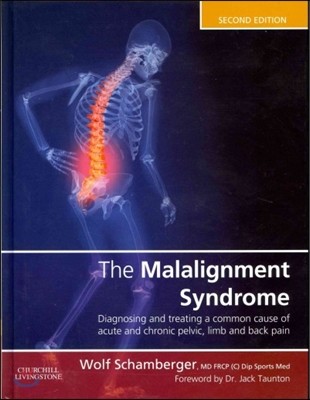The Malalignment Syndrome