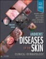 Andrews' Diseases of the Skin, 13/E