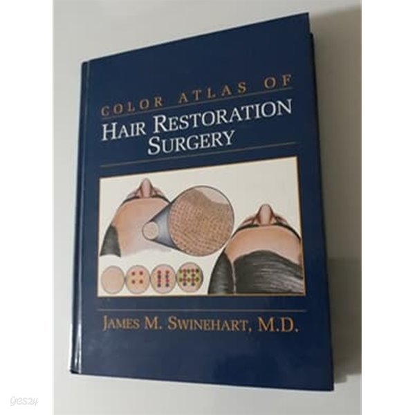 COLOR ATLAS OF HAIR RESTORATION OF SURGERY