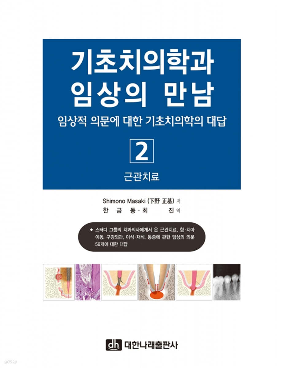 기초치의학과 임상의 만남 2 근관치료