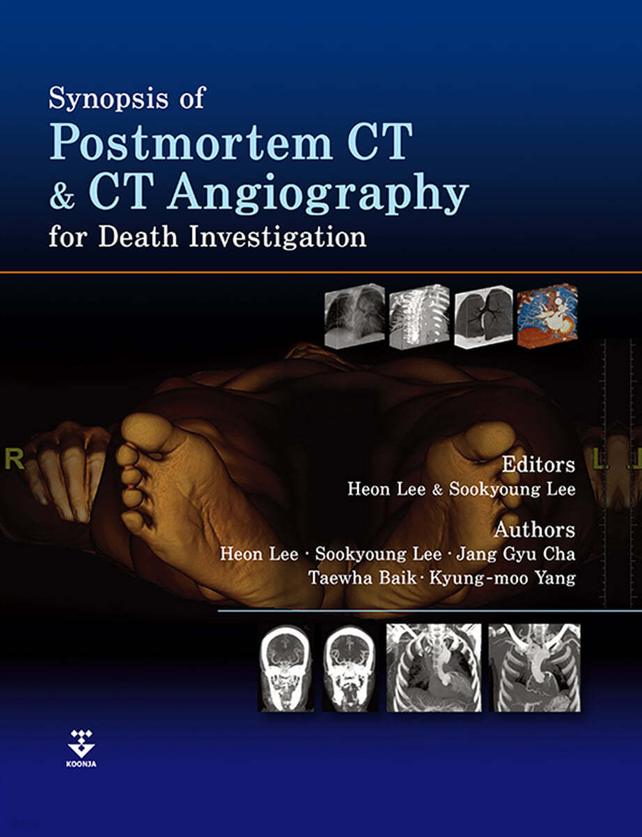 Synopsis of Postmortem CT and CT Angiography for Death Investigation