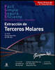 사랑니 발치 Extraccion de Terceros Molares (스페인어판)