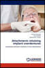 Attachments retaining implant overdentures