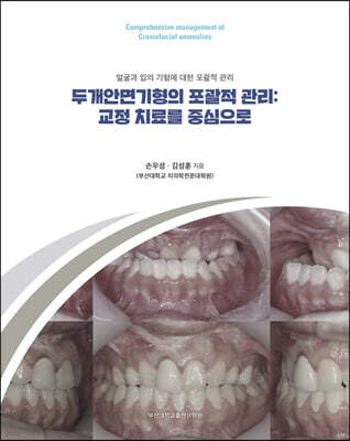 두개안면기형의 포괄적 관리: 교정 치료를 중심으로