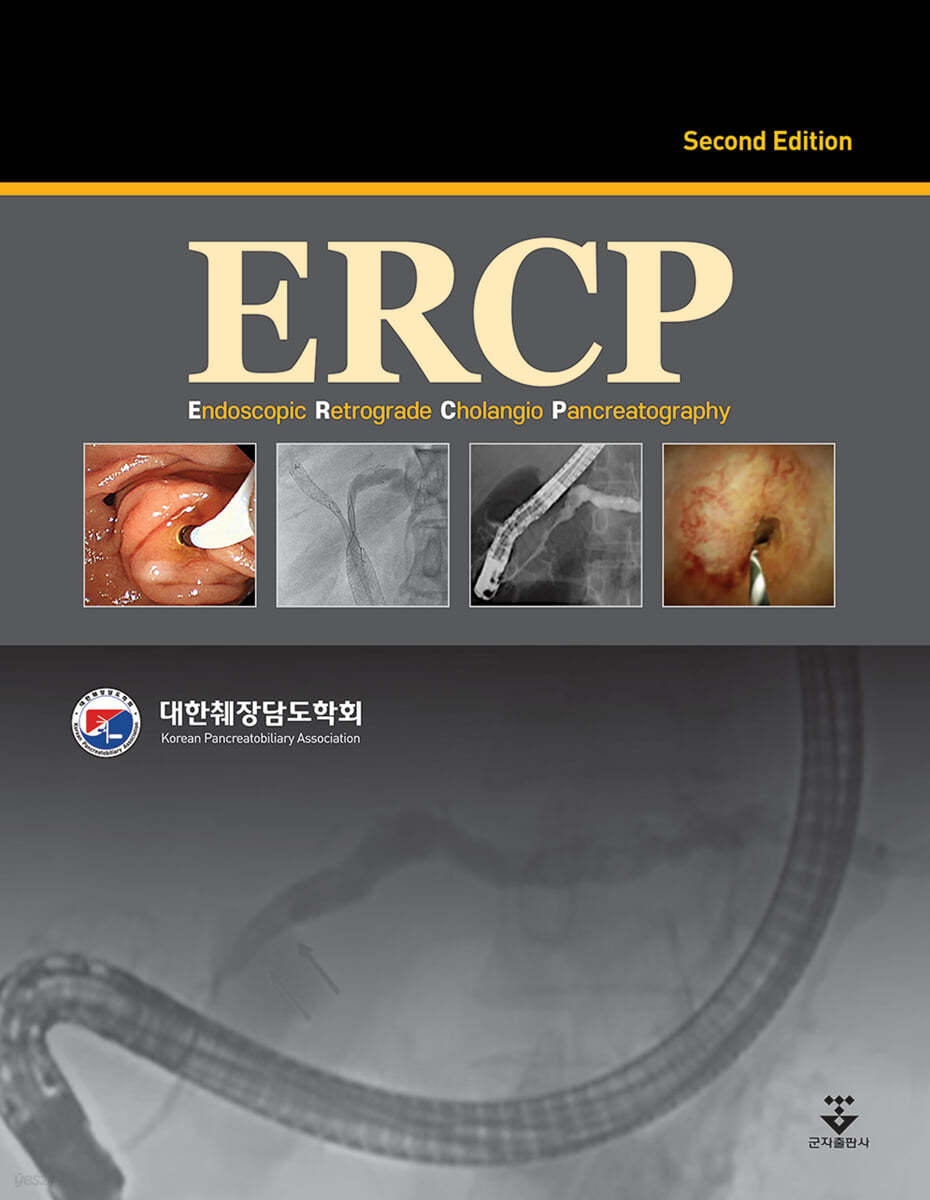 ERCP