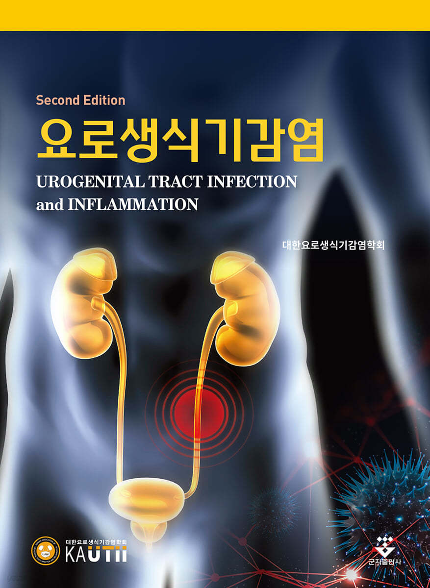 요로생식기감염