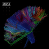 Muse - The 2nd Law (Ltd. ED)(180G)(2LP)