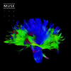 Muse - The 2nd Law (Ltd. ED)(180G)(2LP)