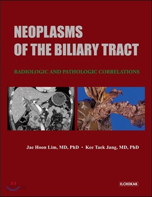 Neoplasms of the Biliary Tract