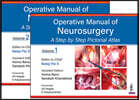 Operative Manual of Neurosurgery: A Step by Step Pictorial Atlas