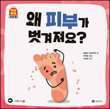왜 피부가 벗겨져요?