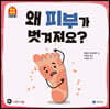 왜 피부가 벗겨져요?