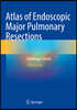 Atlas of Endoscopic Major Pulmonary Resections