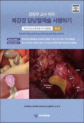 강창무 교수 따라 복강경 담낭절제술 시행하기 제2편