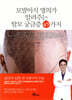 모발이식 명의가 알려주는 탈모 궁금증 49가지