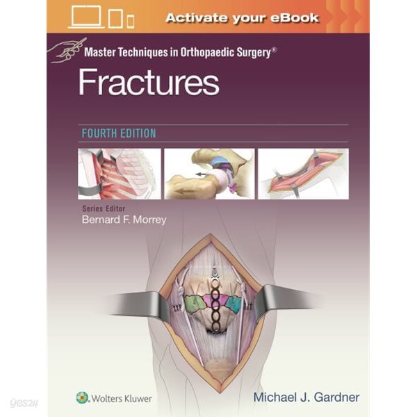 Fractures, 4/ed (Master Techniques in Orthopaedic Surgery) (ISBN : 9781975139407)