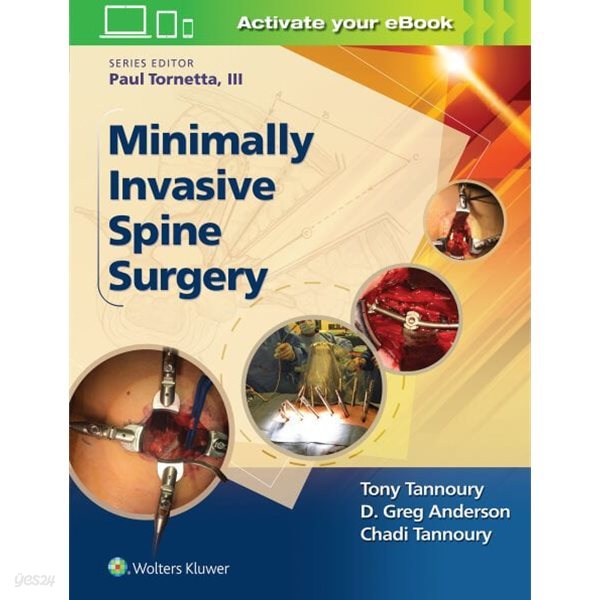 Minimally Invasive Spine Surgery