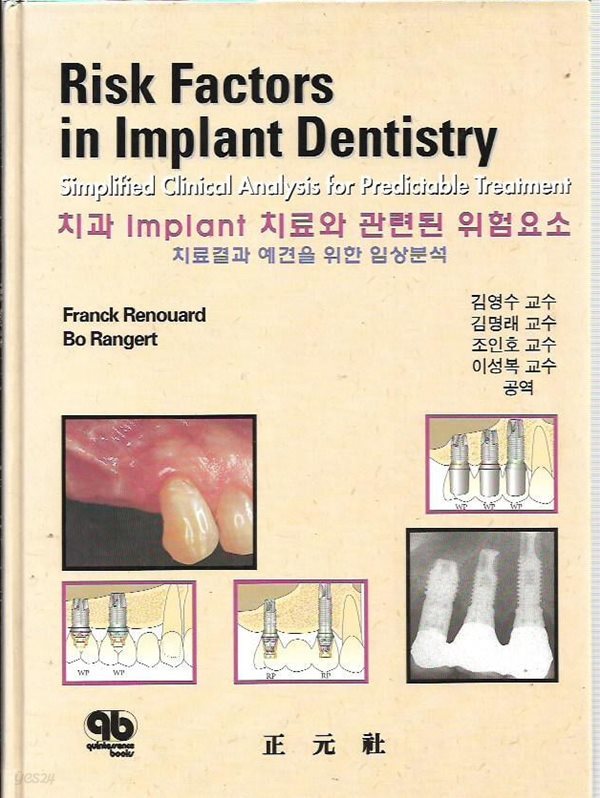 치과 Implant 치료와 관련된 위험요소 - 치료결과 예견을 위한 임상분석 (양장)