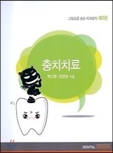 그림으로 보는 치과상식 제2편 충치치료