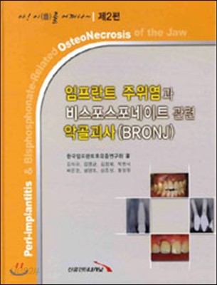 임프란트 주위염과 비스포스포네이트 관련 악골괴사 BRONJ 제 2편