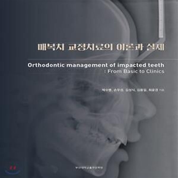 매복치 교정치료의 이론과 실제 (Orthodontic management of impacted teeth: From Basic to Clinics)