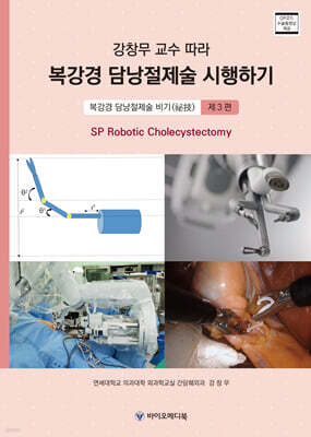 강창무 교수 따라 복강경 담낭절제술 시행하기 제3편