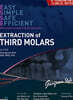 Extraction of Third Molars