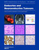 Endocrine and Neuroendocrine Tumours: Who Classification of Tumours, 5/E