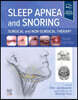 Sleep Apnea and Snoring