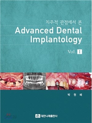 치주적 관점에서 본 Advanced Dental Implantology Vol.I  