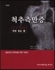 척추측만증