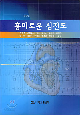 흥미로운 심전도