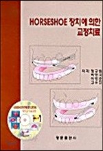 HORSESHOE 장치에 의한 교정치료