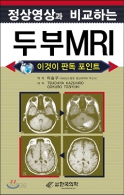 정상영상과 비교하는 두부 MRI
