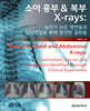 소아 흉부 복부 X-rays