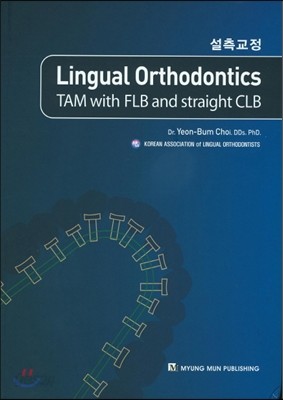 Lingual Orthodontics(설측교정) TAM with FLB and straight CLB