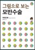 그림으로 보는 모반수술