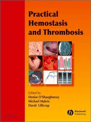 Practical Hemostasis and Thrombosis