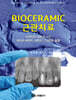 BIOCERAMIC 근관치료