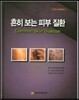 흔히보는 피부질환