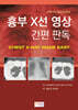 흉부 X선 영상 간편 판독(Chest X-Ray Made Easy)