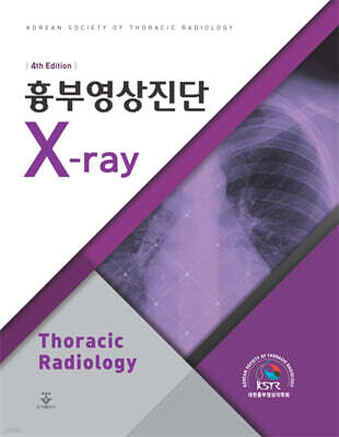 흉부영상진단 X-ray