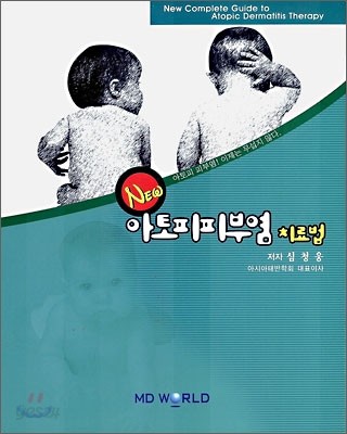 새로운 아토피 피부염 치료법