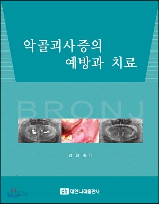 악골괴사증의 예방과 치료 