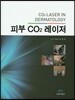 피부 CO2 레이저